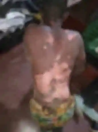 Katete Mob Sets Suspected Criminal Ablaze, Another Seriously Injured After Vigilante Attack