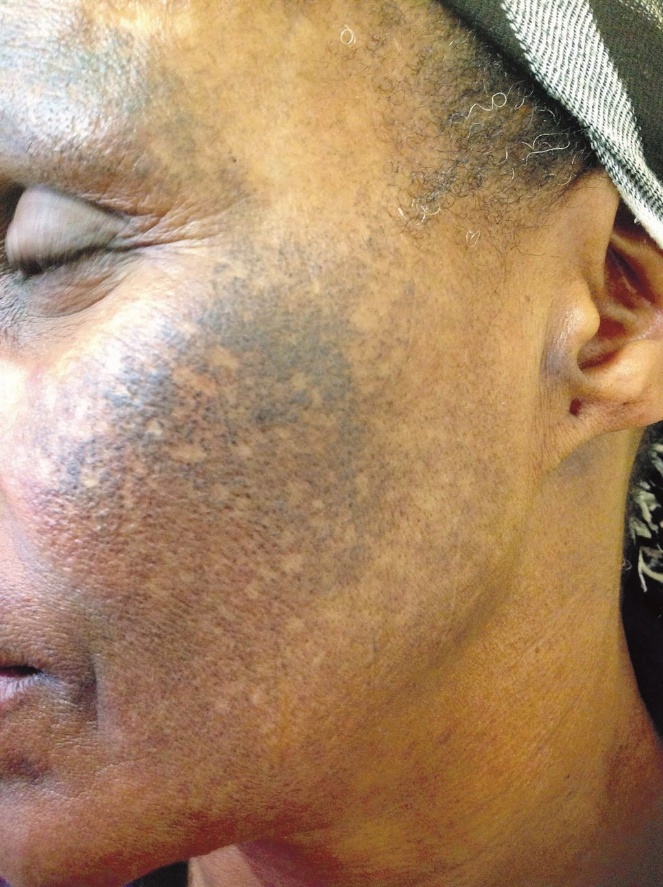 Childhood trauma may be behind people seeking surgery or bleaching to alter body appearance